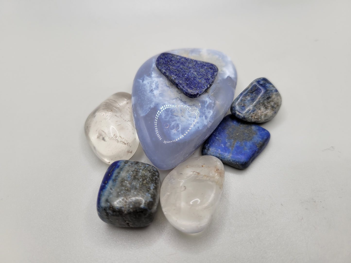 Anxiety Stone Set