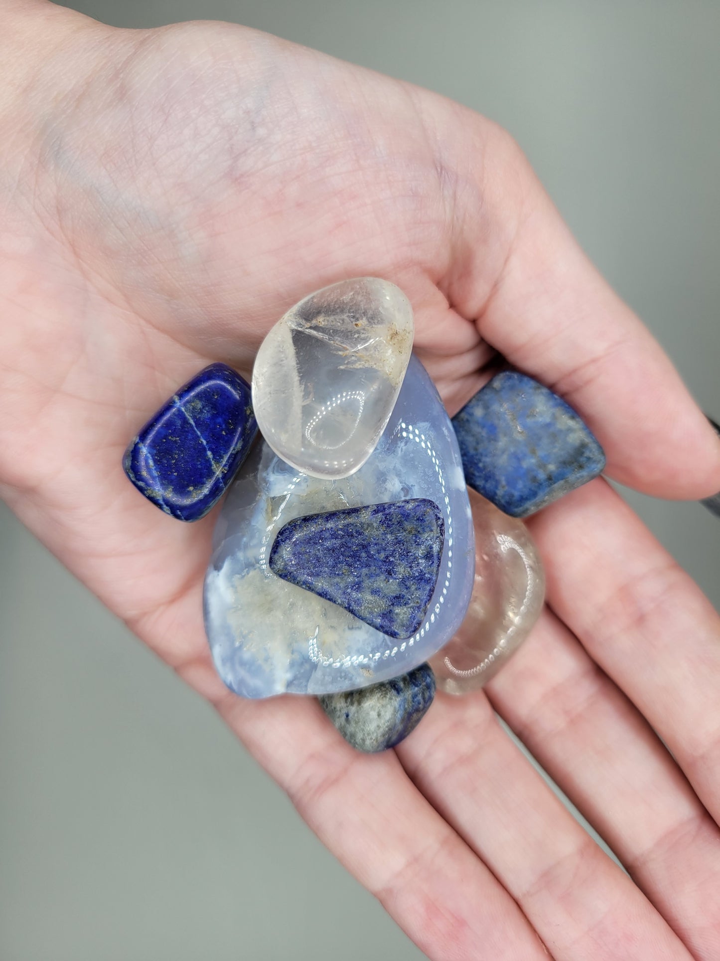 Anxiety Stone Set